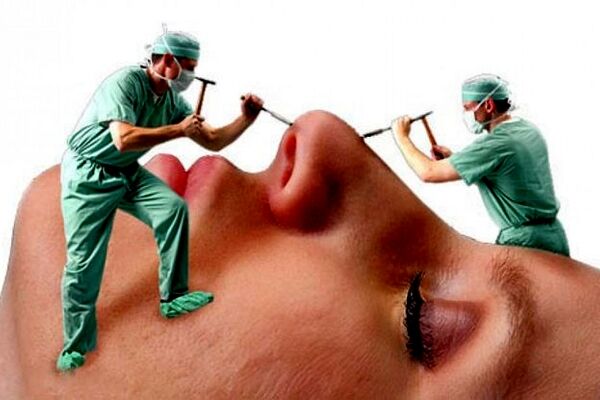 تب تند جراحی‌های زیبایی در کشور/ مانور دلالان در فضای مجازی 